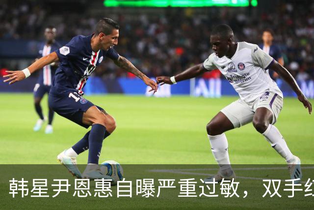 韩星尹恩惠自曝严重过敏，双手红肿蔓延至全脸，痒到整宿睡不着觉
